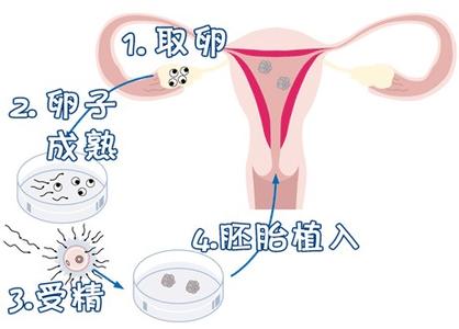私人志愿者代孕服务怎么选